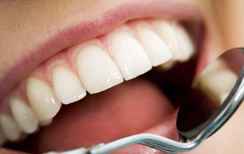 دندان های تمیزتر به معنای قلب سالم تر