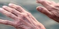 این داده‌ها به شما می‌گویند که به پارکینسون مبتلا شده‌اید!
