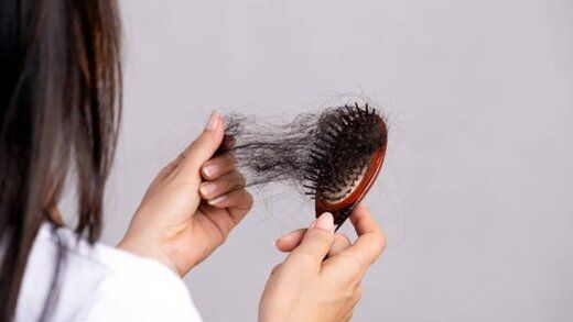 هشدار؛ ریزش مو در زنان، علامت ابتلا به این بیماری های خطرناک است