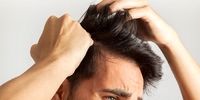 عوامل تأثیرگذار بر ریزش مو را بشناسید