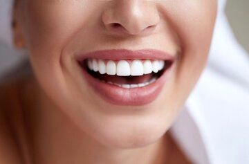 هشدار؛  عوارض غیرقابل‌جبران کمبود این ویتامین‌ها برای دندان