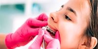  پوسیدگی دندان چه بلایی سر بقیه اعضای بدن می‌آورد؟