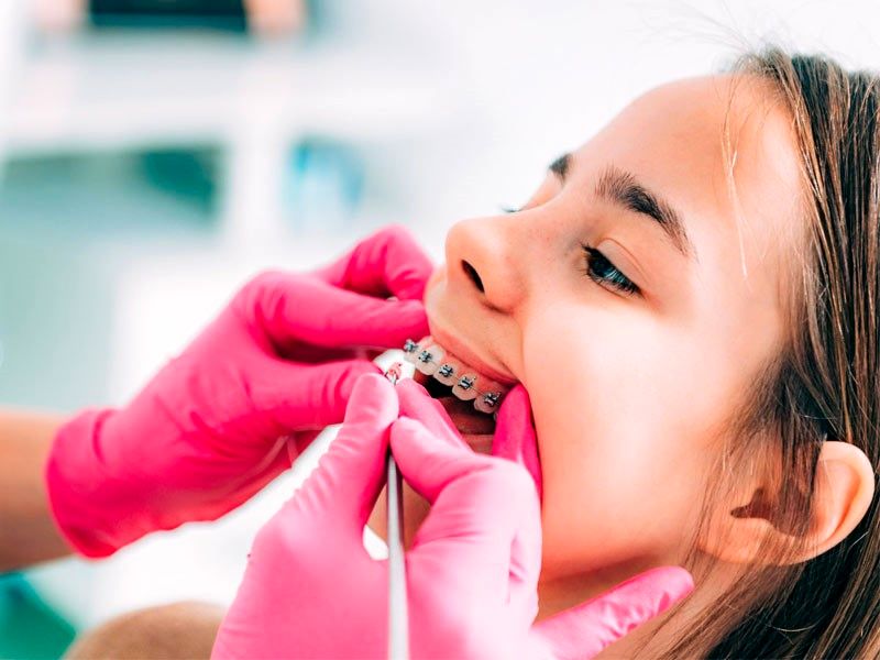  پوسیدگی دندان چه بلایی سر بقیه اعضای بدن می‌آورد؟