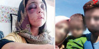 تصاویر شکنجه زن جوان رودباری 