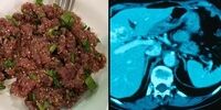 با خوردن این غذای عجیب می میرید!
