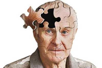 این نشانه‌های آلزایمر قبل از  ۶۵ سالگی ظاهر می‌شوند