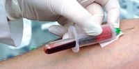 آزمایش CBC چیست؟ |  10 نکته آزمایش خون که پزشک هرگز به شما نخواهد گفت