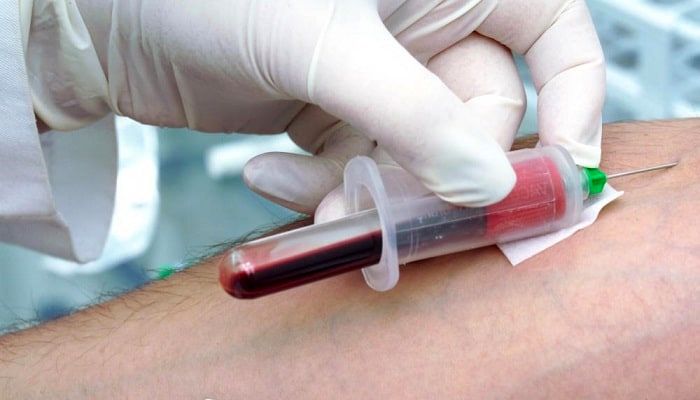 آزمایش خونی که مرگ را پیش‌بینی می‌کند1