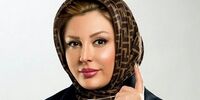تغییر چهره عجیب خانم بازیگر معروف بعد از عمل زیبایی+عکس