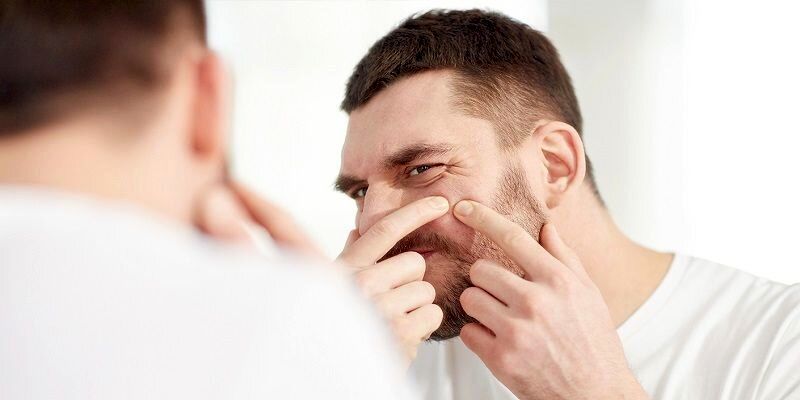 19 راهکار برای مبارزه با جوشهای سر سفید صورت / چرا جوش های چرکی به وجود می آید؟