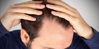 معجزه باورنکردنی این روغن مو در رشد موها 