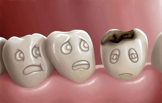 این 5 عادت دندان‌هایتان را خراب می‌کند
