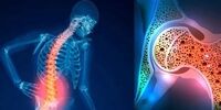 اگر ویتامین D نخورید؛ این بیماری مرگبار به سراغتان می آید
