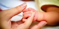  تولد نوزادی بدون چشم + تصاویر
