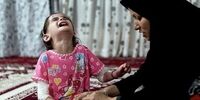 بیماری پروانه‌ای چیست و چه علائمی دارد؟ 
