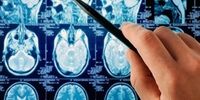 آسان‌ترین روش تشخیص مرگبارترین سرطان