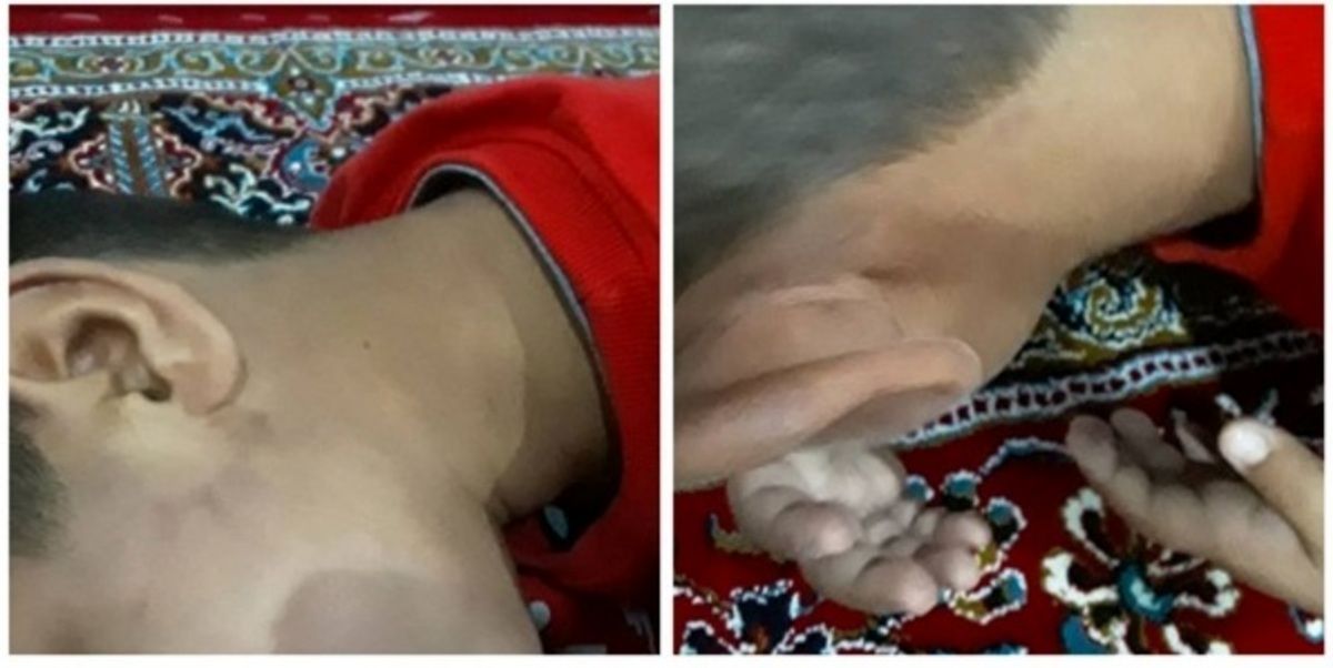شکنجه وحشتناک دانش آموزکلاس اول ایلامی توسط معلم!+ تصاویر