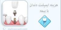 هزینه ایمپلنت دندان با بیمه