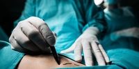 جزئیات فوت جوان 23 ساله بر اثر جراحی زیبایی / رئیس بیمارستان احضار شد
