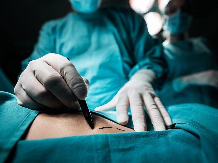 جزئیات فوت جوان 23 ساله بر اثر جراحی زیبایی / رئیس بیمارستان احضار شد