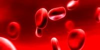 علائم شایع کم خونی در بدن چیست؟