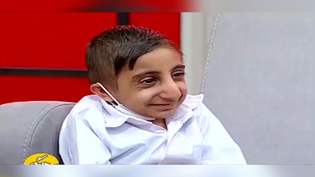 رونمایی از کوچکترین مرد ایران! + فیلم