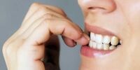 هشدار به کسانی که ناخن هایشان را می جوند 