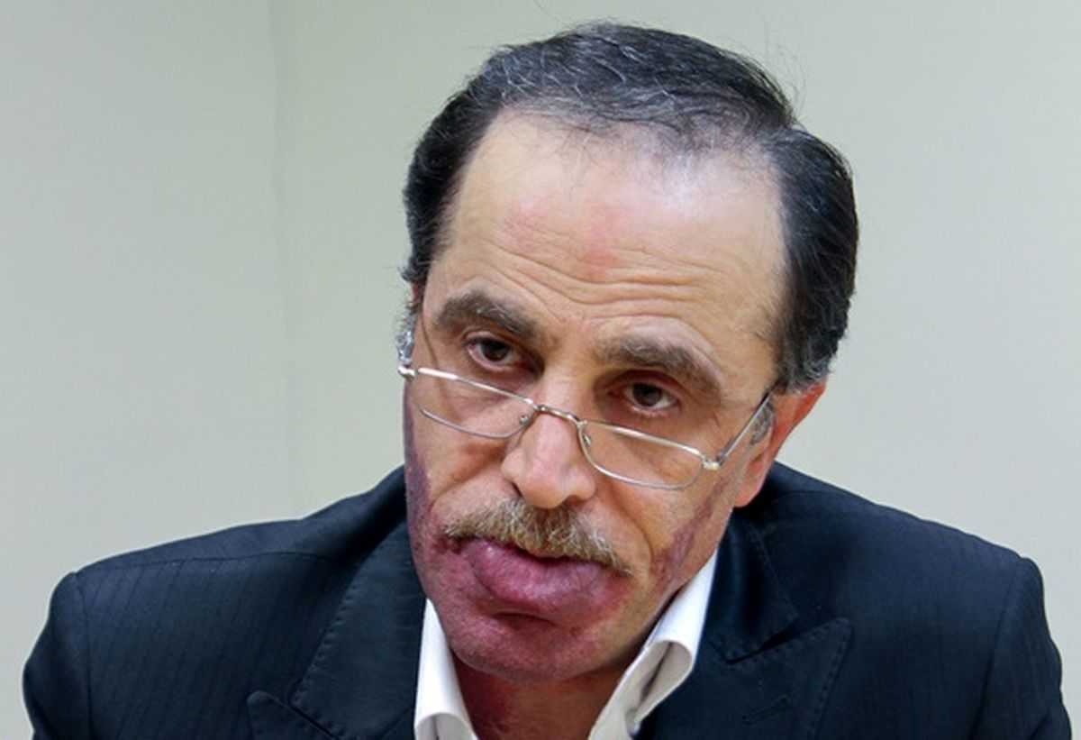 طعنه یک حقوقدان به لایحه دو فوریتی جدید دولت و شباهت آن به طرح صیانت / برادر من! عهد نابستن از آن به که ببندی و نپایی