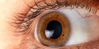 ۶ بیماری خطرناک که چشم‌ ها در مورد آنها هشدار می‌دهند