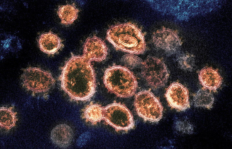 این ویروس های خطرناک کشنده تر از کرونا هستند!
