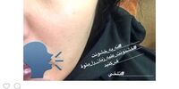 حمله فیزیکی به بازیگر زن  +عکس

