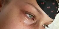 مدل معروف بیماری وحشتناک خود را فاش کرد!+تصاویر