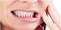  ۵ اشتباه رایجی که باعث زردی دندان ها می‌شود