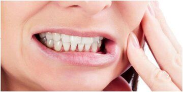  ۵ اشتباه رایجی که باعث زردی دندان ها می‌شود