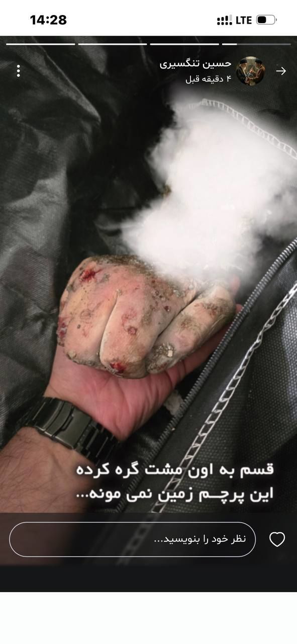 عکس/ مشت گره کرده شهید تنگسیری در زمان شهادت
